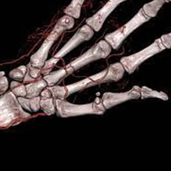 3D CT Hand